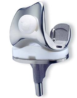 Knee Replacement knee replacement